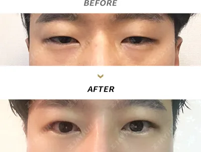 Before & After