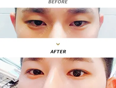 Before & After