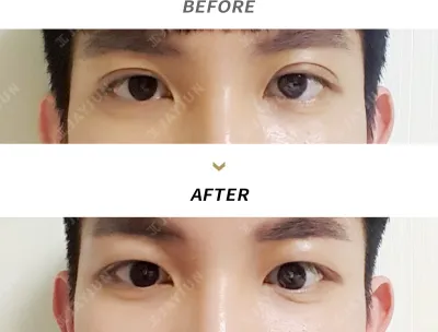 Before & After