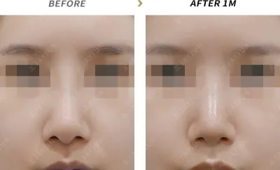 Before & After