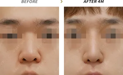 Before & After