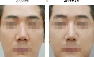 Before & After