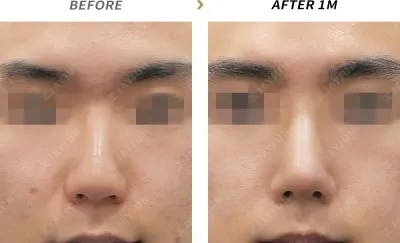 Before & After