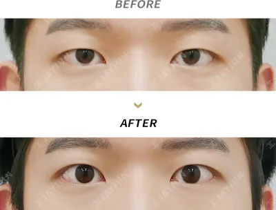 Before & After
