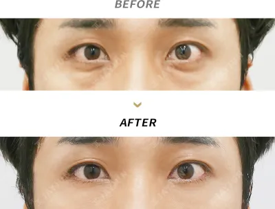 Before & After