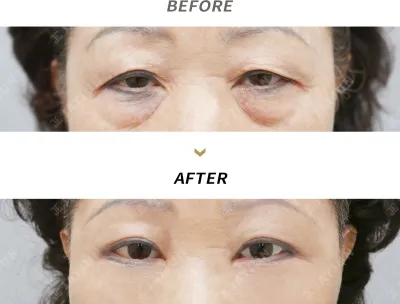 Before & After