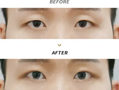 Before & After