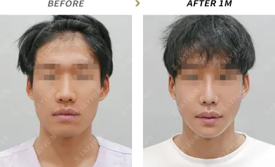 Before & After