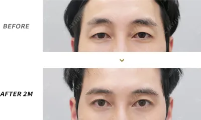 Before & After