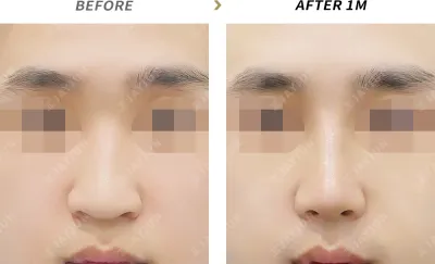 Before & After