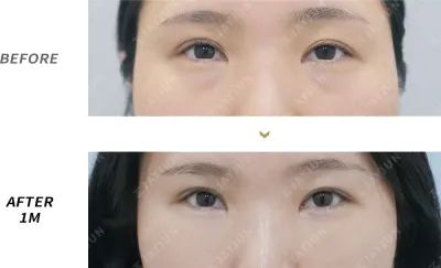 Before & After