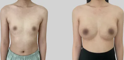 Before & After