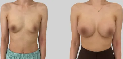 Before & After
