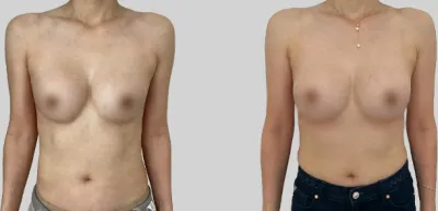 Before & After