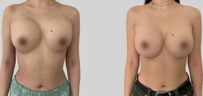 Before & After