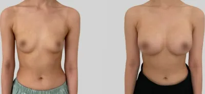 Before & After