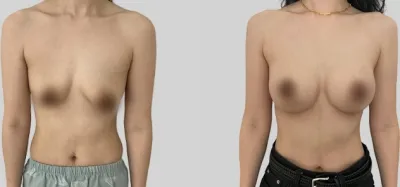 Before & After