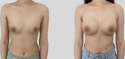 Before & After