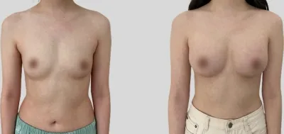 Before & After