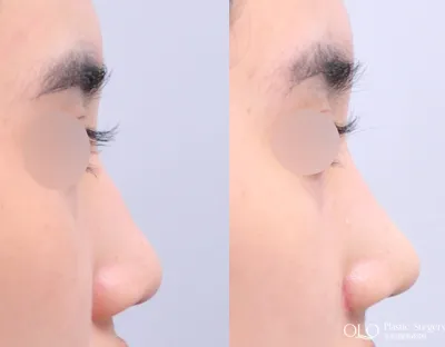 Before & After