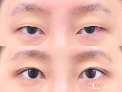 Before & After