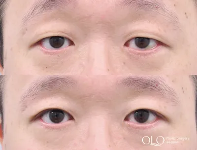 Before & After