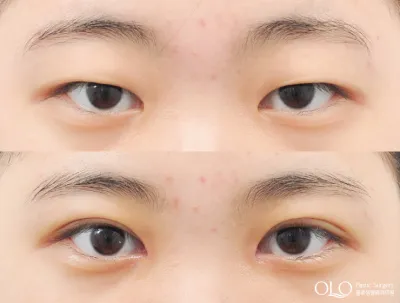 Before & After