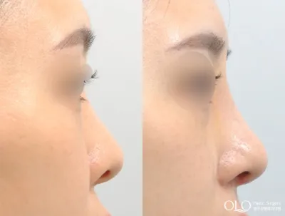 Before & After