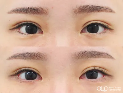 Before & After