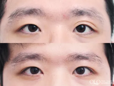 Before & After