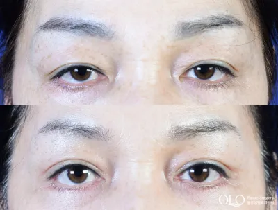 Before & After
