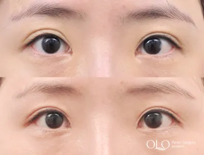 Before & After