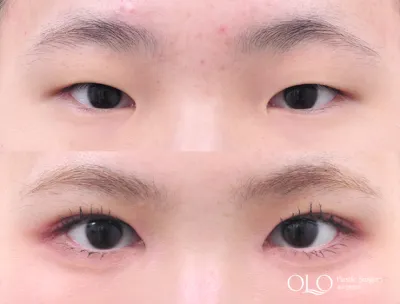Before & After