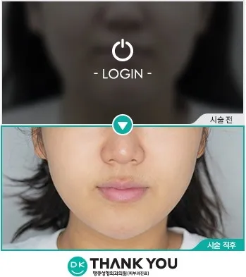Before & After