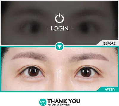 Before & After