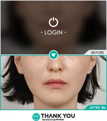 Before & After