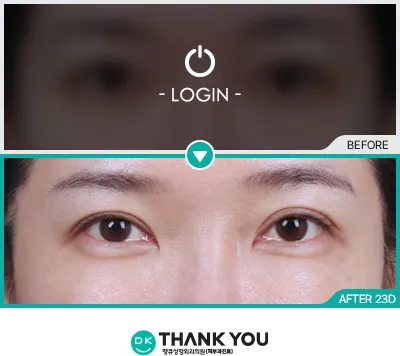 Before & After