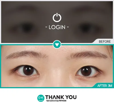 Before & After