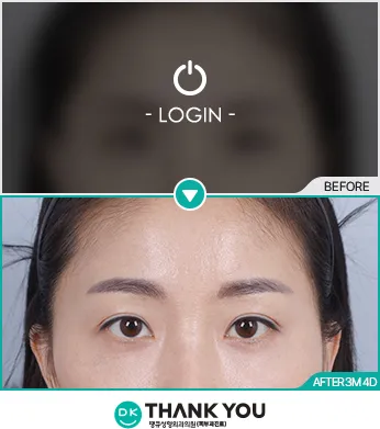 Before & After
