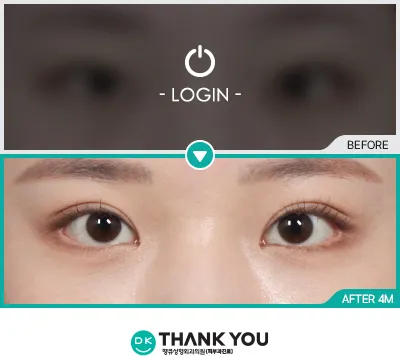 Before & After