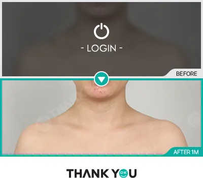 Before & After