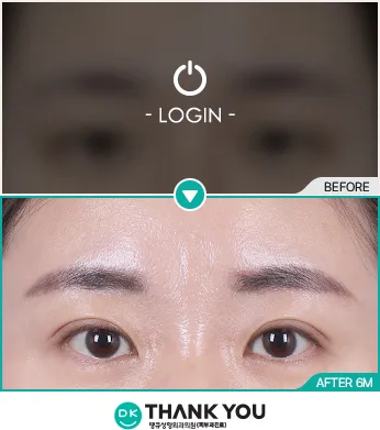Before & After