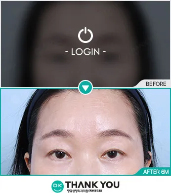 Before & After
