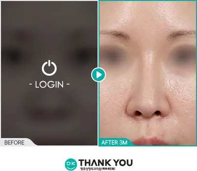 Before & After