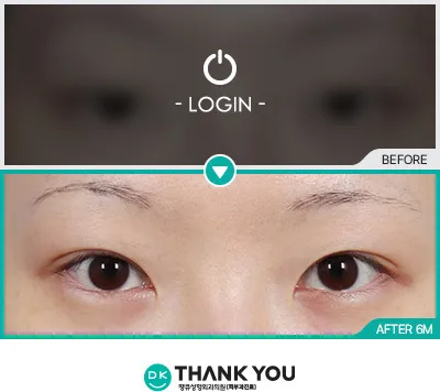 Before & After