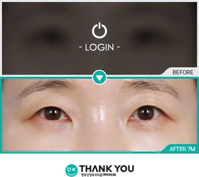 Before & After