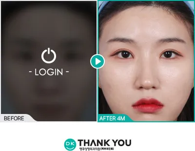 Before & After
