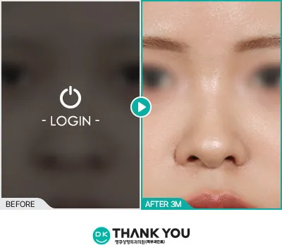Before & After