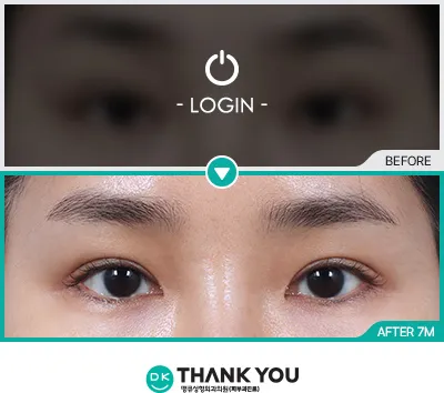 Before & After