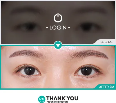 Before & After